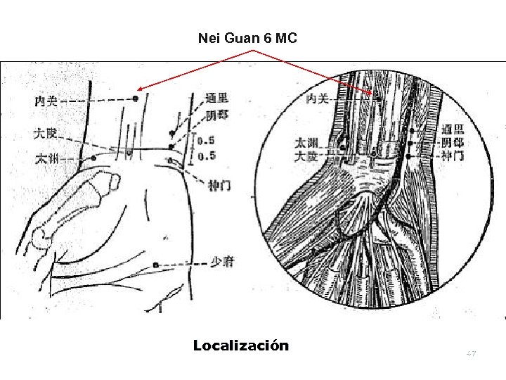 Nei Guan 6 MC Localización 47 