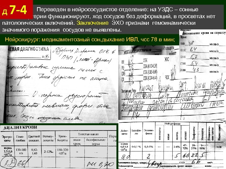 Д Переведен в нейрососудистое отделение: на УЗДС сонные 7 -4 артерии функционируют, ход сосудов
