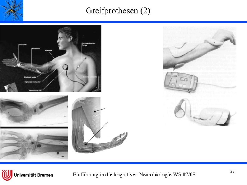 Greifprothesen (2) Freehand-System, Popovic et al. , 2002 Einführung in die kognitiven Neurobiologie WS