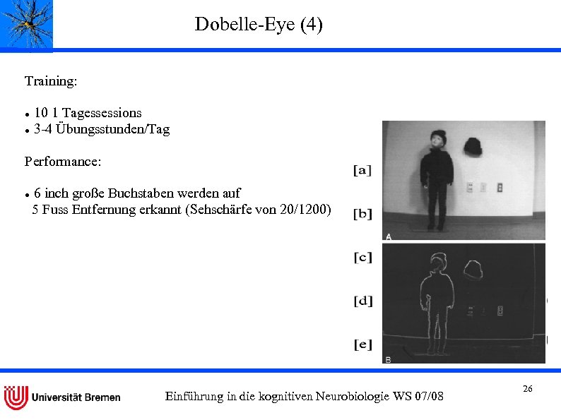 Dobelle-Eye (4) Training: 10 1 Tagessessions 3 -4 Übungsstunden/Tag Performance: 6 inch große Buchstaben