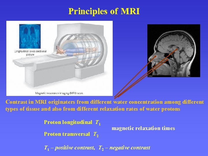 Principles of MRI Contrast in MRI originaters from different water concentration among different types