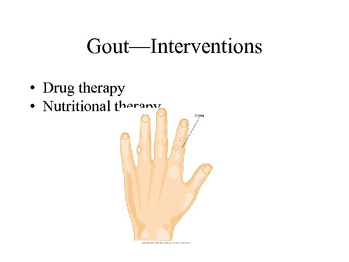 Gout—Interventions • Drug therapy • Nutritional therapy 