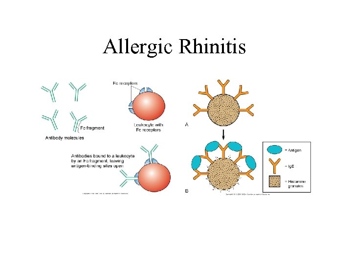 Allergic Rhinitis 