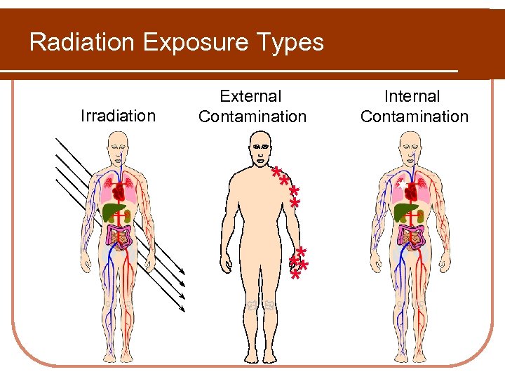 Radiation Exposure Types Irradiation External Contamination ** * * ** ** Internal Contamination ¬¬
