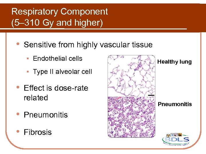 Respiratory Component (5– 310 Gy and higher) • Sensitive from highly vascular tissue §
