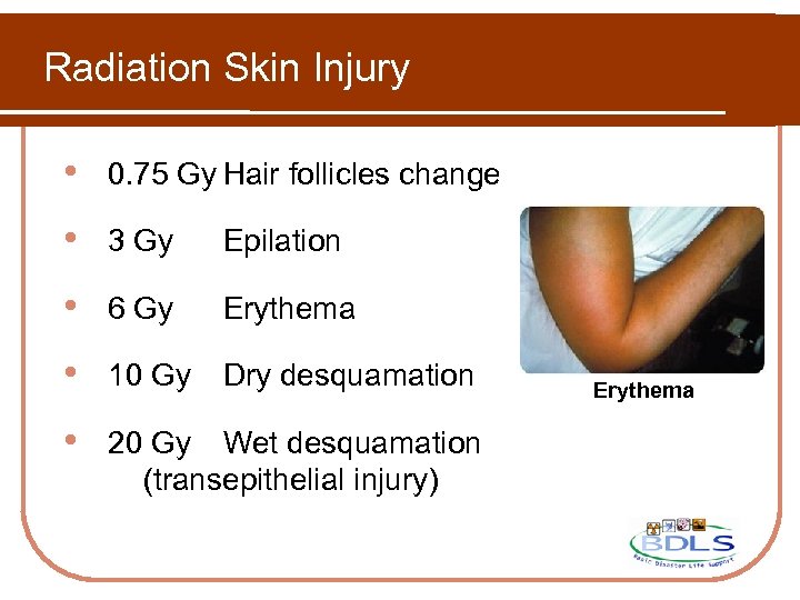 Radiation Skin Injury • 0. 75 Gy Hair follicles change • 3 Gy Epilation