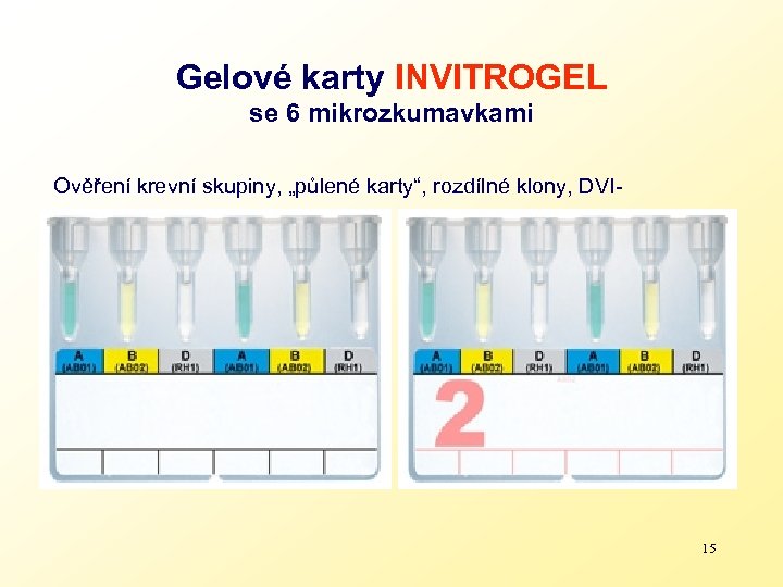 Gelové karty INVITROGEL se 6 mikrozkumavkami Ověření krevní skupiny, „půlené karty“, rozdílné klony, DVI-