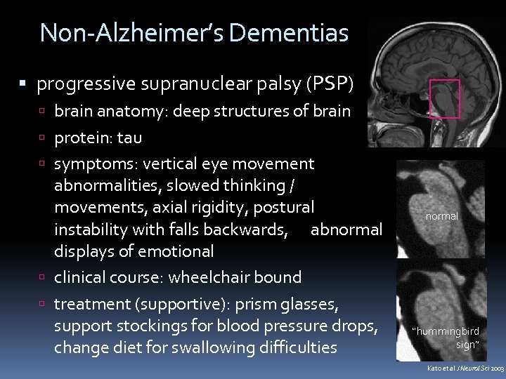 Non-Alzheimer’s Dementias progressive supranuclear palsy (PSP) brain anatomy: deep structures of brain protein: tau