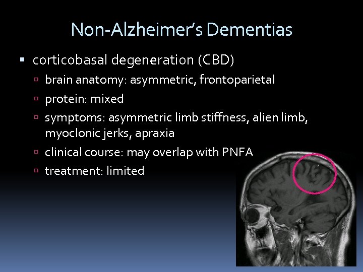 Non-Alzheimer’s Dementias corticobasal degeneration (CBD) brain anatomy: asymmetric, frontoparietal protein: mixed symptoms: asymmetric limb