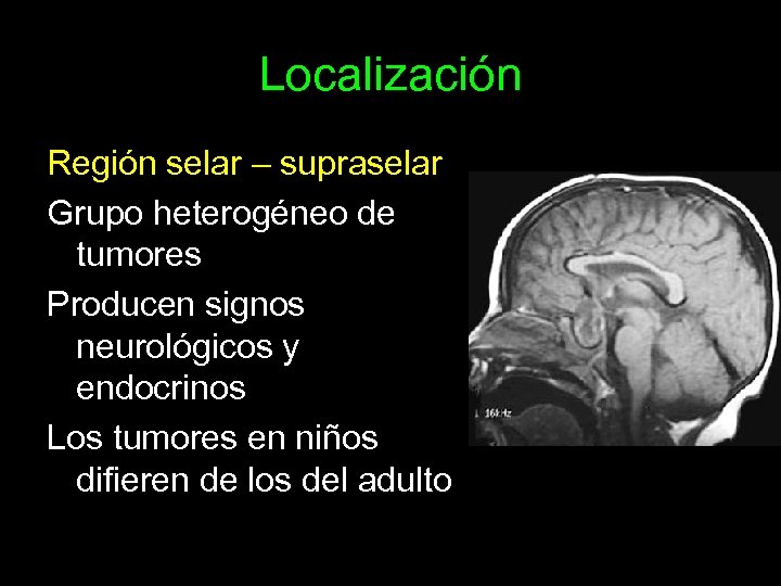 Localización Región selar – supraselar Grupo heterogéneo de tumores Producen signos neurológicos y endocrinos