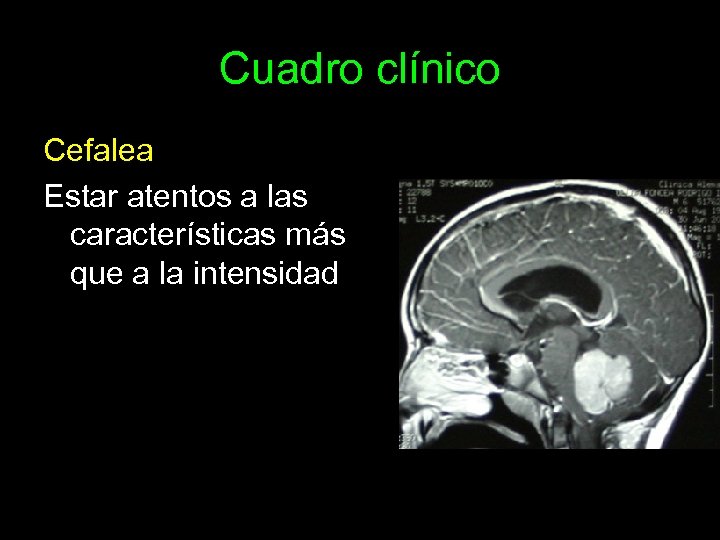 Cuadro clínico Cefalea Estar atentos a las características más que a la intensidad 