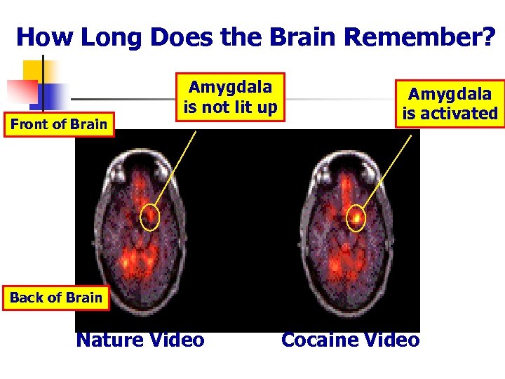 How Long Does the Brain Remember? Front of Brain Amygdala is not lit up