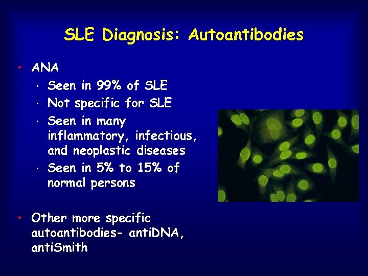 SLE Diagnosis: Autoantibodies • ANA • Seen in 99% of SLE • Not specific