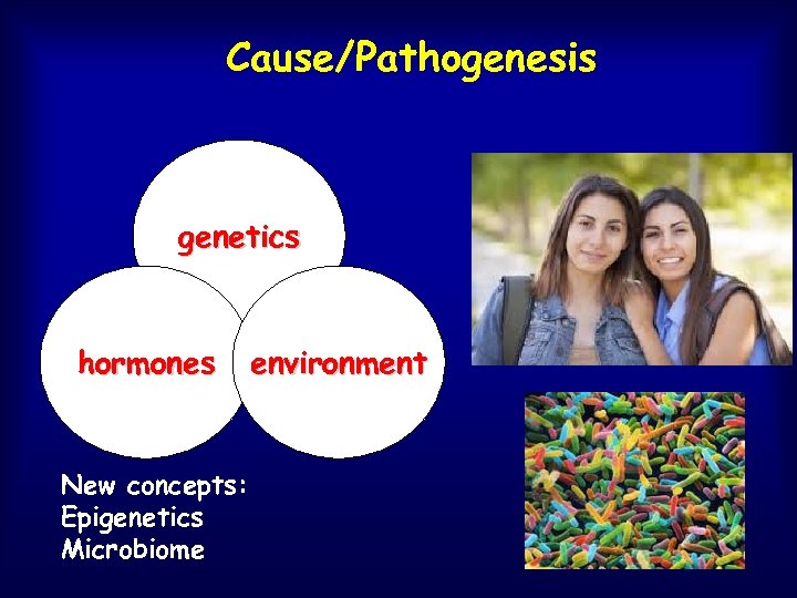 Cause/Pathogenesis genetics hormones New concepts: Epigenetics Microbiome environment 