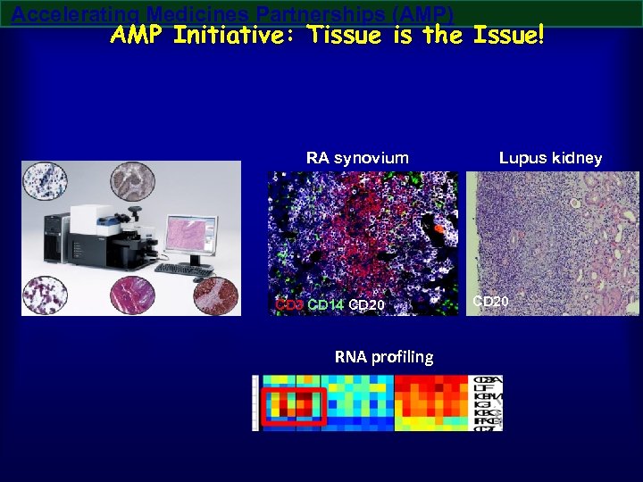 Accelerating Medicines Partnerships (AMP) AMP Initiative: Tissue is the Issue! RA synovium CD 3