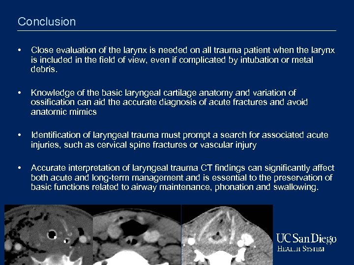 Conclusion • Close evaluation of the larynx is needed on all trauma patient when