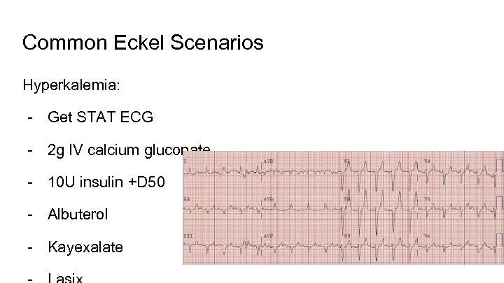 Common Eckel Scenarios Hyperkalemia: - Get STAT ECG - 2 g IV calcium gluconate