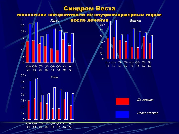 Синдром Веста показатели когерентности по внутриполушарным парам после лечения Ксред. Дельта Тета До лечения