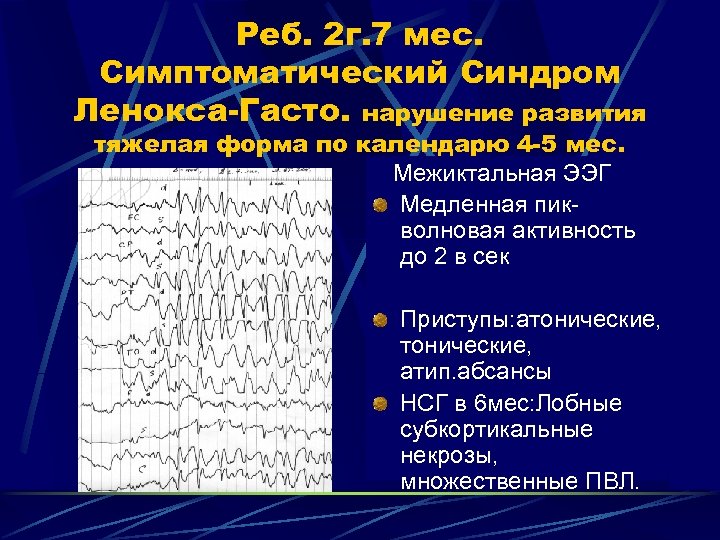 Реб. 2 г. 7 мес. Симптоматический Синдром Ленокса-Гасто. нарушение развития тяжелая форма по календарю