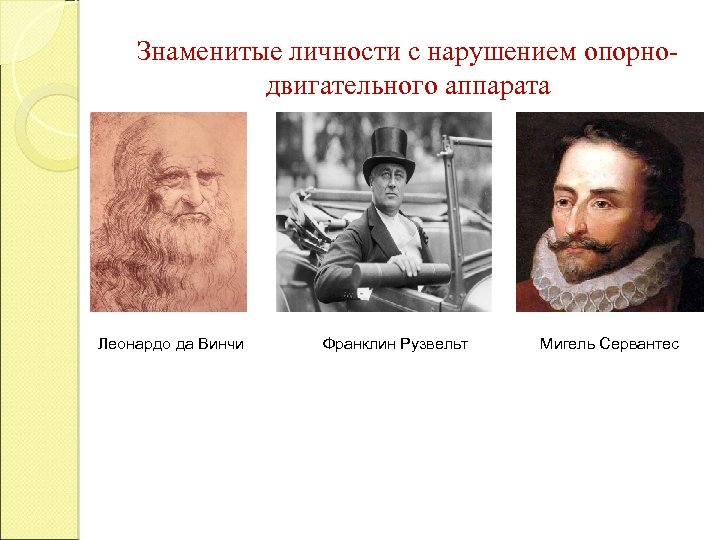 Знаменитые личности с нарушением опорнодвигательного аппарата Леонардо да Винчи Франклин Рузвельт Мигель Сервантес 