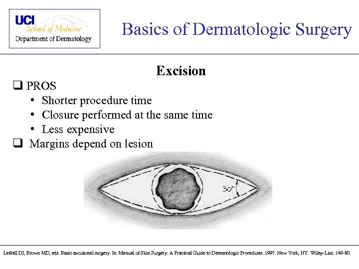 Basics of Dermatologic Surgery Excision q PROS • Shorter procedure time • Closure performed