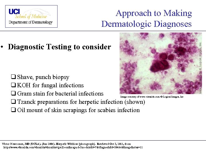 Approach to Making Dermatologic Diagnoses • Diagnostic Testing to consider q Shave, punch biopsy