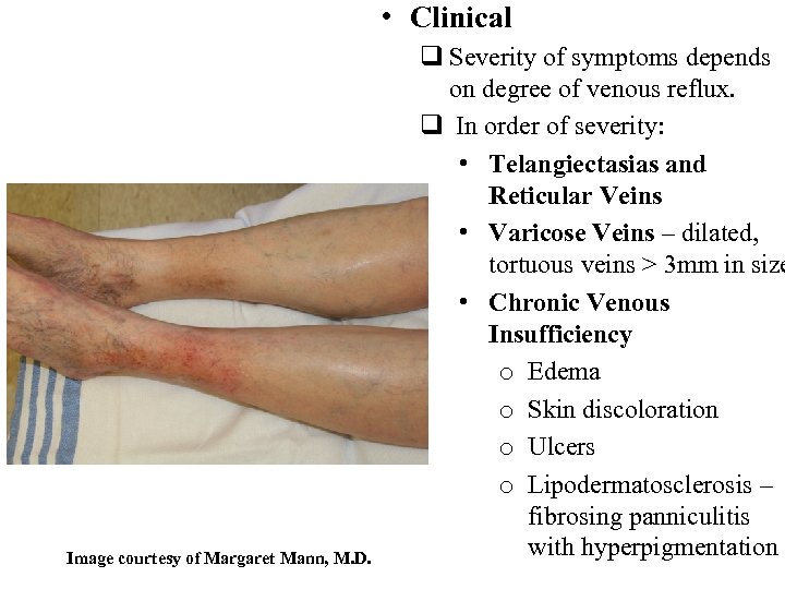  • Clinical Image courtesy of Margaret Mann, M. D. q Severity of symptoms