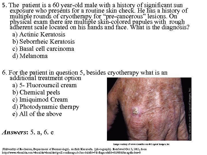 5. The patient is a 60 year-old male with a history of significant sun