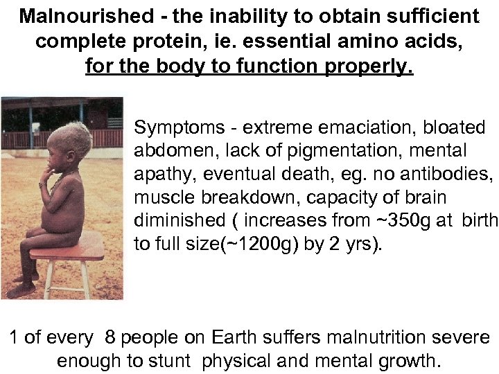 Malnourished - the inability to obtain sufficient complete protein, ie. essential amino acids, for