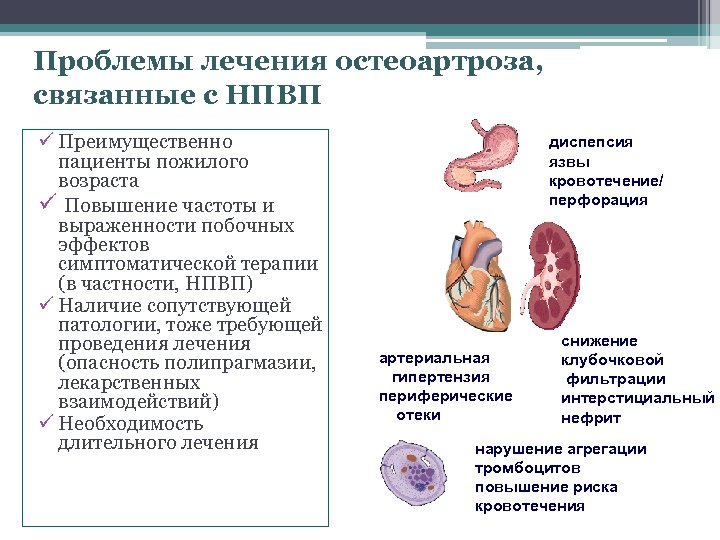 Проблемы лечения остеоартроза, связанные с НПВП ü Преимущественно пациенты пожилого возраста ü Повышение частоты