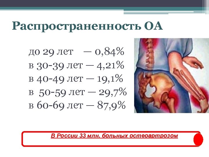 Распространенность ОА до 29 лет — 0, 84% в 30 -39 лет — 4,