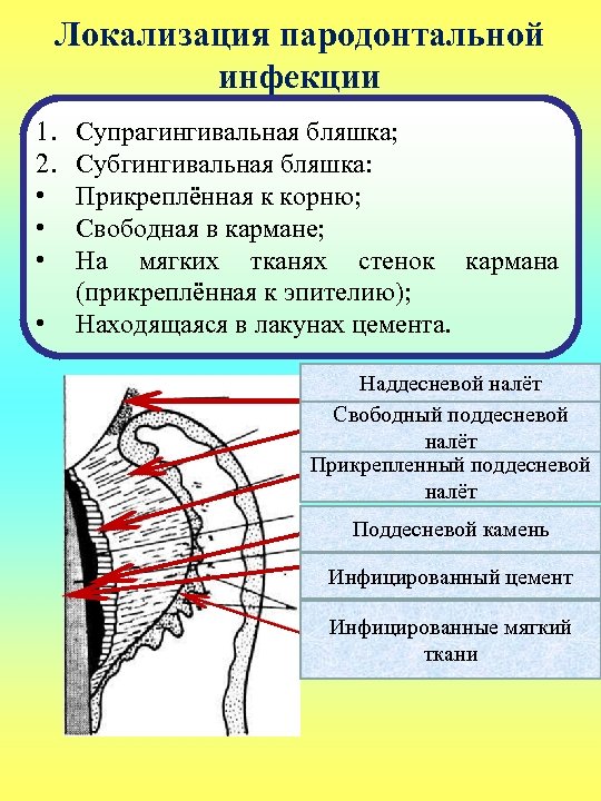 Локализация пародонтальной инфекции 1. 2. • • Супрагингивальная бляшка; Субгингивальная бляшка: Прикреплённая к корню;