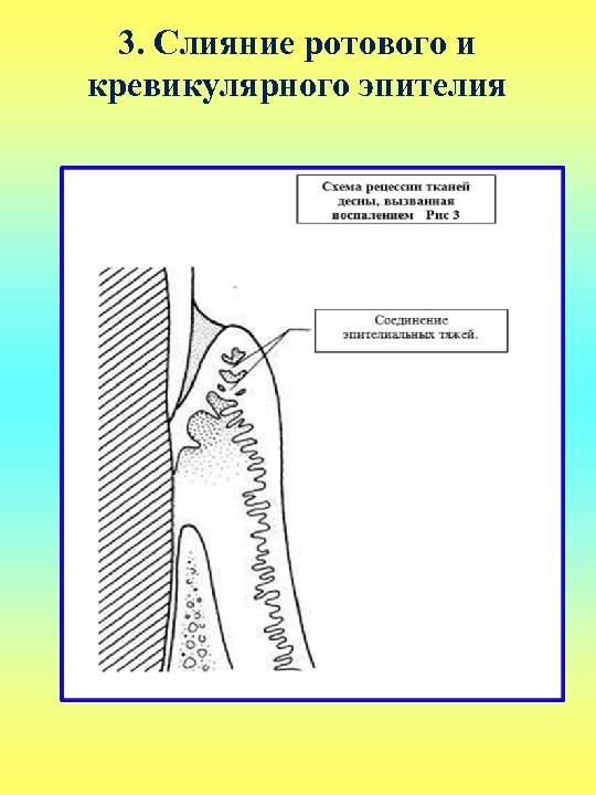3. Слияние ротового и кревикулярного эпителия 