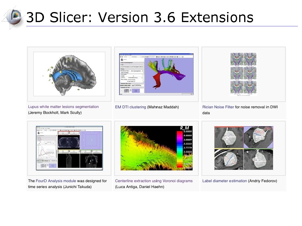 3 D Slicer: Version 3. 6 Extensions 