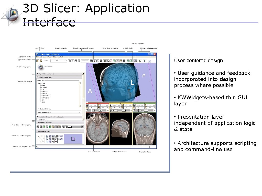 3 D Slicer: Application Interface User-centered design: • User guidance and feedback incorporated into