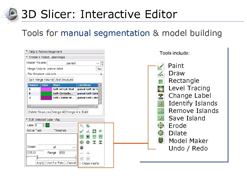 3 D Slicer: Interactive Editor Tools for manual segmentation & model building Tools include: