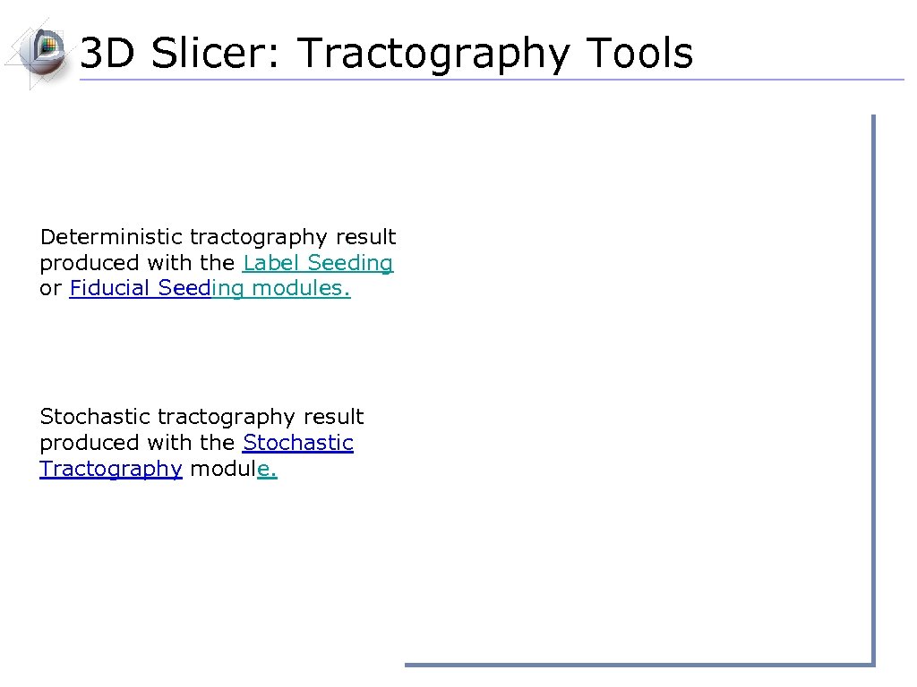 3 D Slicer: Tractography Tools Deterministic tractography result produced with the Label Seeding or