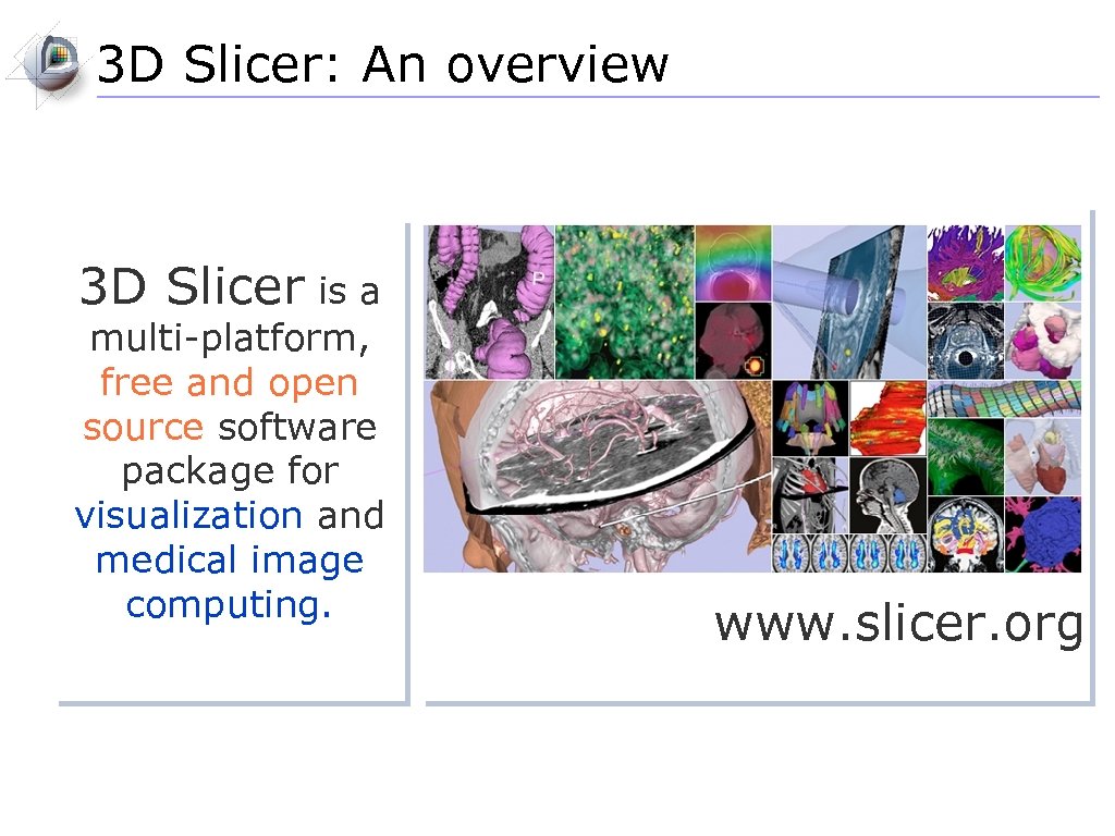 3 D Slicer: An overview 3 D Slicer is a multi-platform, free and open