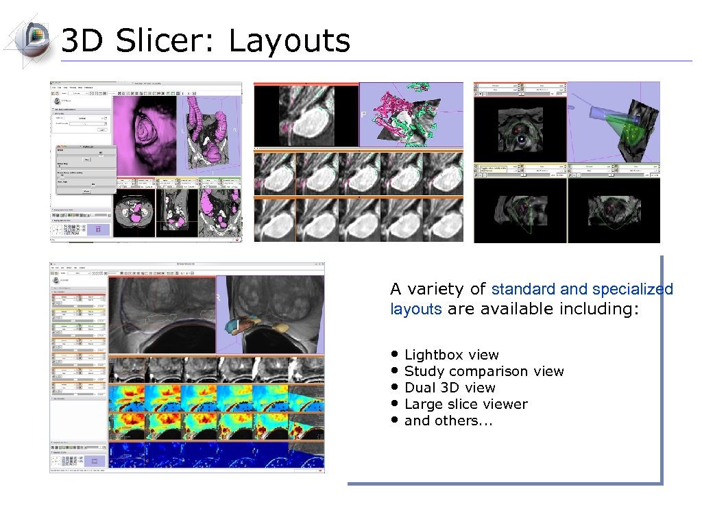 3 D Slicer: Layouts A variety of standard and specialized layouts are available including: