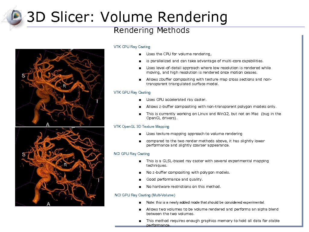 3 D Slicer: Volume Rendering Methods VTK CPU Ray Casting ■ Uses the CPU