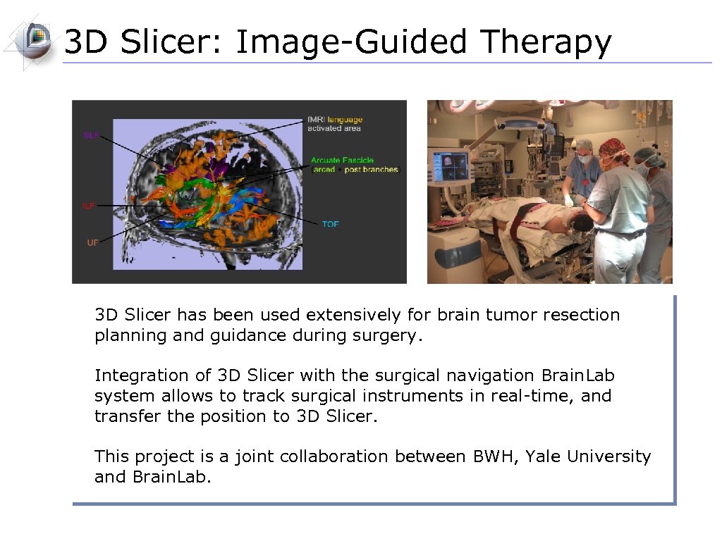 3 D Slicer: Image-Guided Therapy 3 D Slicer has been used extensively for brain