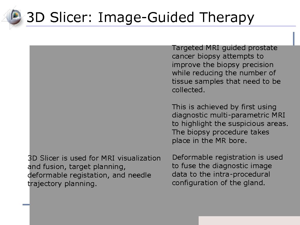 3 D Slicer: Image-Guided Therapy Targeted MRI guided prostate cancer biopsy attempts to improve
