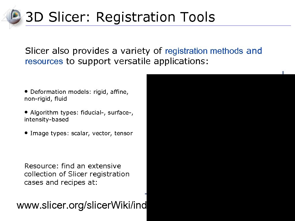3 D Slicer: Registration Tools Slicer also provides a variety of registration methods and