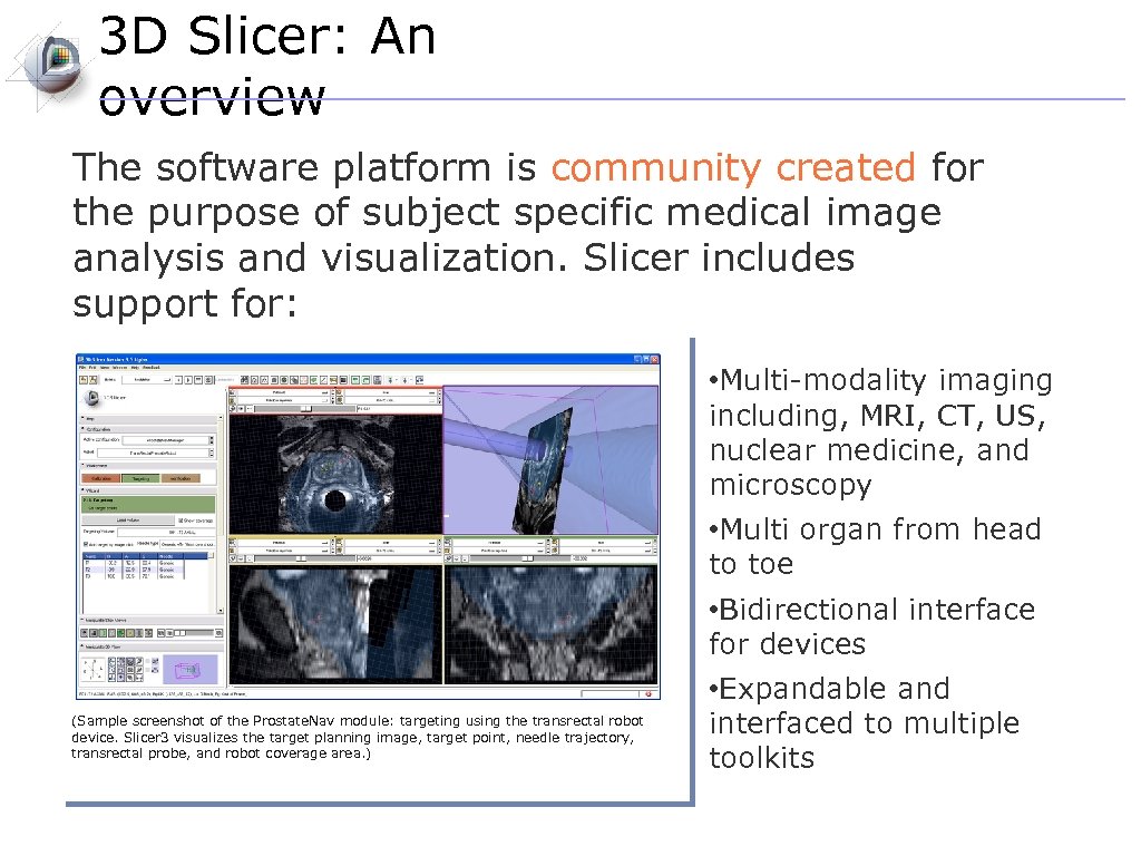 3 D Slicer: An overview The software platform is community created for the purpose