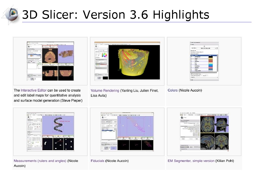 3 D Slicer: Version 3. 6 Highlights 