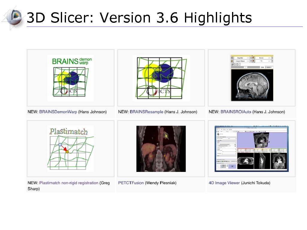 3 D Slicer: Version 3. 6 Highlights 