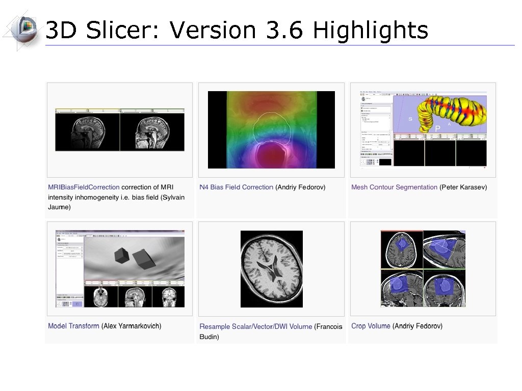 3 D Slicer: Version 3. 6 Highlights 