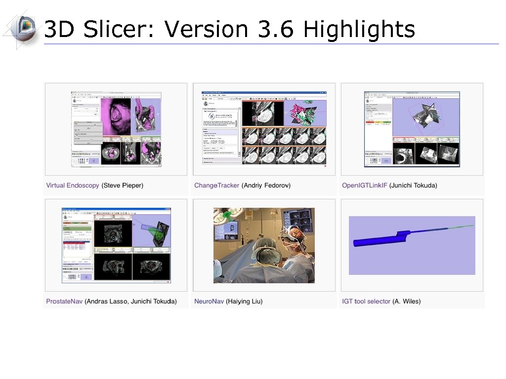 3 D Slicer: Version 3. 6 Highlights 