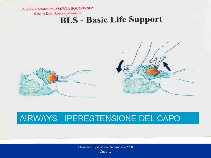 A = Airways AIRWAYS - IPERESTENSIONE DEL CAPO Centrale Operativa Provinciale 118 Caserta 