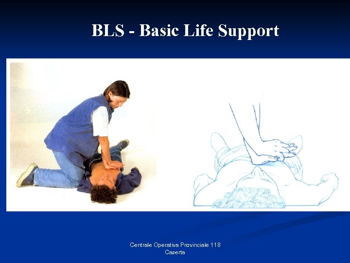 BLS - Basic Life Support Centrale Operativa Provinciale 118 Caserta 